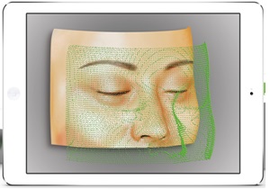 PHOTO Integration
フォトレジストレーションは、iPadリモートコントロールにより顔表面全体をキャプチャすることで、素早く簡単にレジストレーションを実現
患者の顔を3枚撮影するだけで精度の高いレジストレーションを可能にします。
