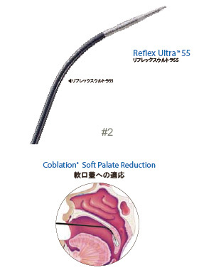 リフレックスウルトラ 55（Reflex Ultra™ 55）
適応例：軟口蓋への適応・口蓋扁桃への適応
